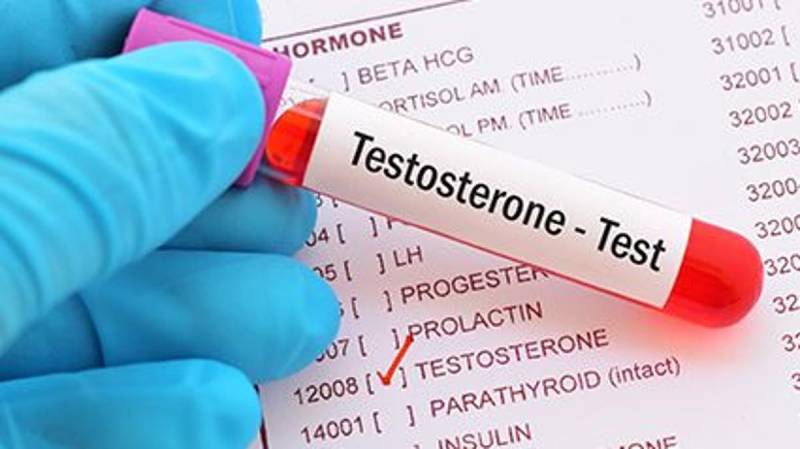 изследване на мъжки хормони - тестостерон